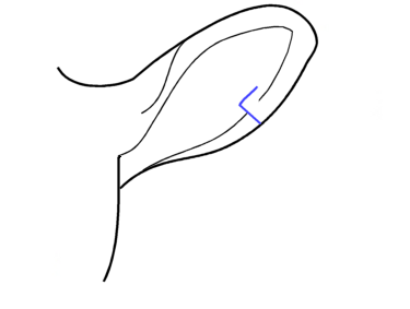 gearradh cròcain